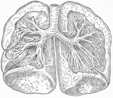 Fig. 10.&mdash;The Lungs And Windpipe. Parts of the lungs have been removed to show the branching of the air tubes or bronchi which pass into them. All the tubes and the surfaces of the lungs communicate with the inner surface of the body through the larynx.