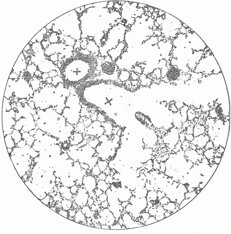 Fig. 6&mdash;Photograph Of A Section Of The Lung Of A Mouse. x x are the air tubes or bronchi which communicate with all of the small spaces. On the walls of the partitions there is a close network of blood vessels which are separated from the air in the spaces by a thin membrane.