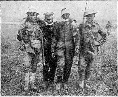 COMRADES AFTER
THE BATTLE

Soldiers bringing in two wounded captives.

PHOTO BY CENTRAL PHOTO SERVICE. N.Y.