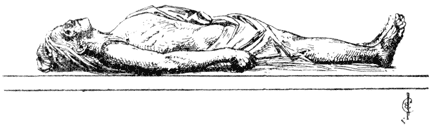 DEAD BODY OF DE BR&Eacute;Z&Eacute;