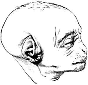 F&oelig;tus of an Orang.