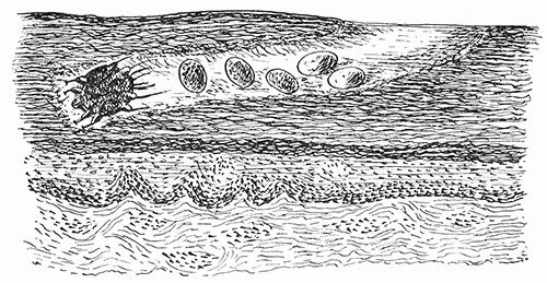 57. Sarcoptes scabiei. Diagrammatic representation of the course in
the skin of man.