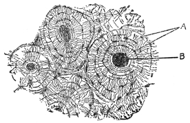 CROSS SECTION OF COMPACT BONE FROM THE SHAFT OF THE
HUMERUS

A, bone cells; B, blood capillaries. (From Martin’s “Human Body”)