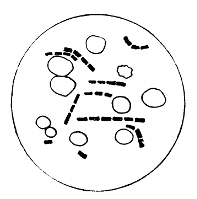 Bacillus of Anthrax and
Blood Corpuscles